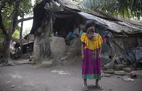 (تصاویر) این دختر هندی، صورت ندارد