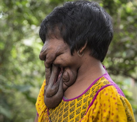 (تصاویر) این دختر هندی، صورت ندارد